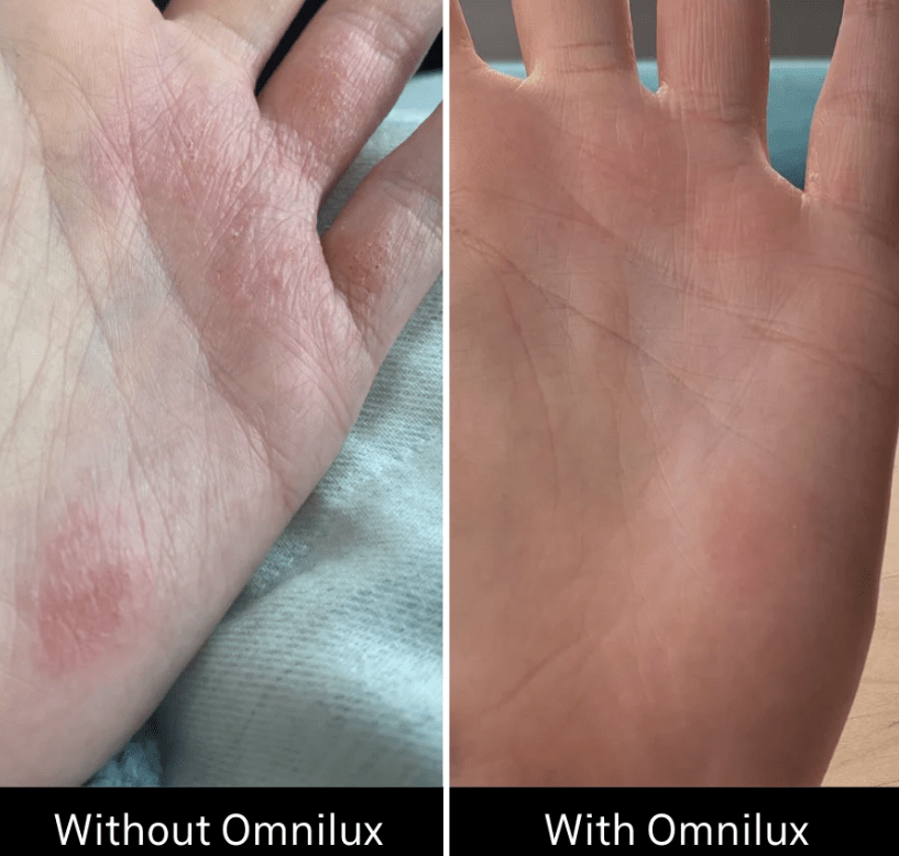 Omnilux Omnilux Contour Glove LED Light Therapy