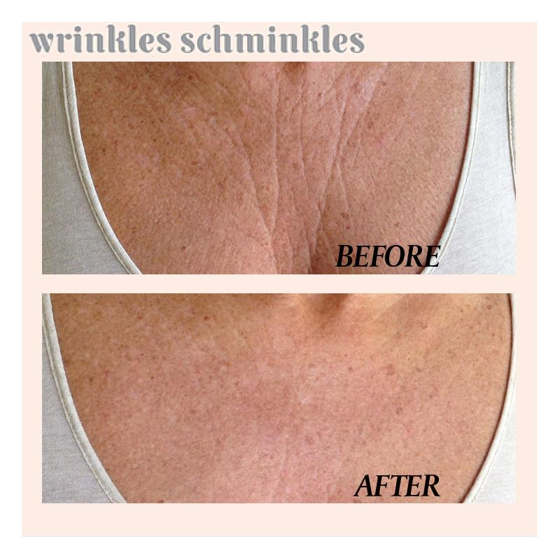 Wrinkles Schminkles Chest Wrinkle Patch