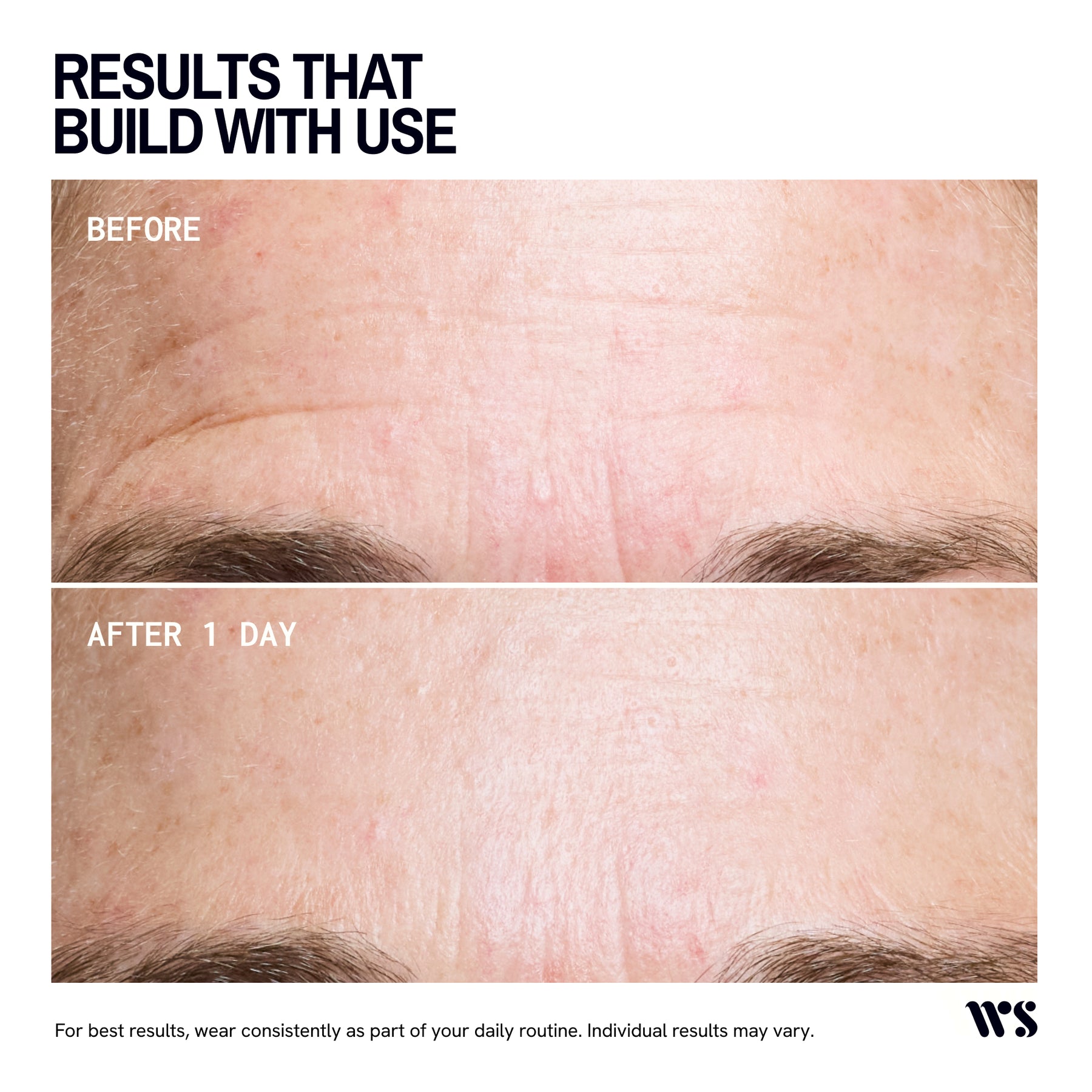 Wrinkles Schminkles Forehead Wrinkle Patch  - 1 Patch