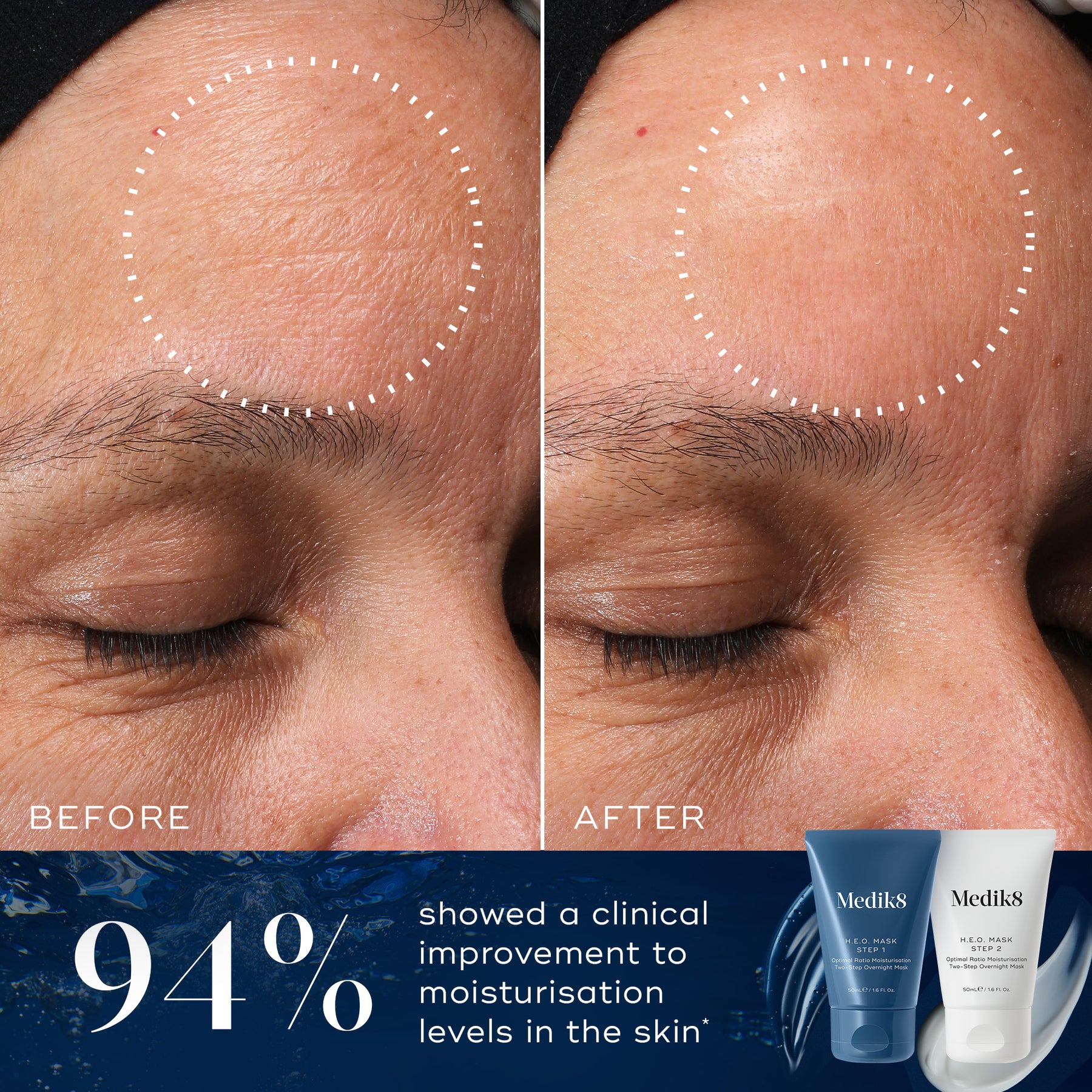Medik8 H.E.O Mask 2x50ml - B&A