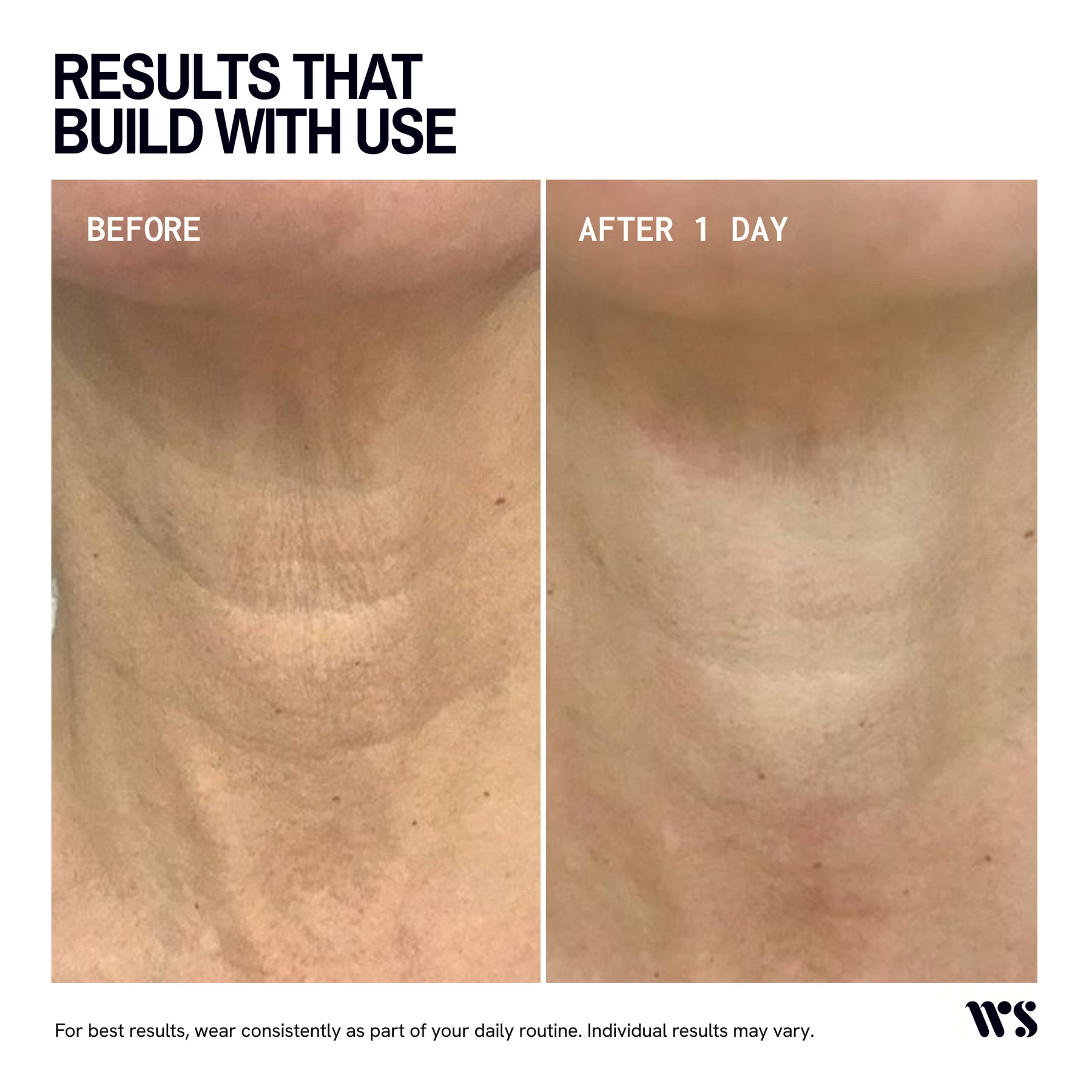 Wrinkles Schminkles Neck Wrinkle Patch