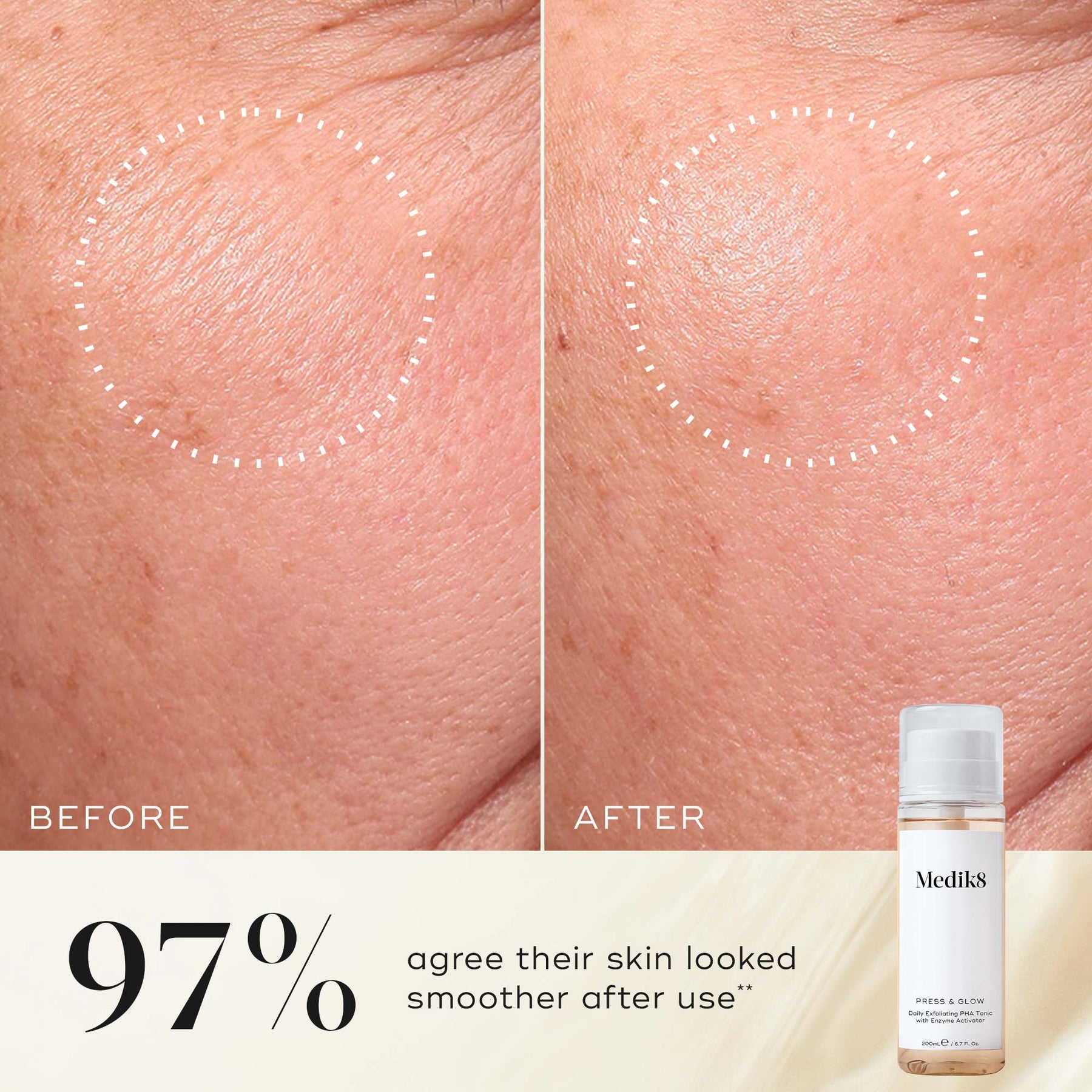 Medik8 Press & Glow Refill 200ml - B&A