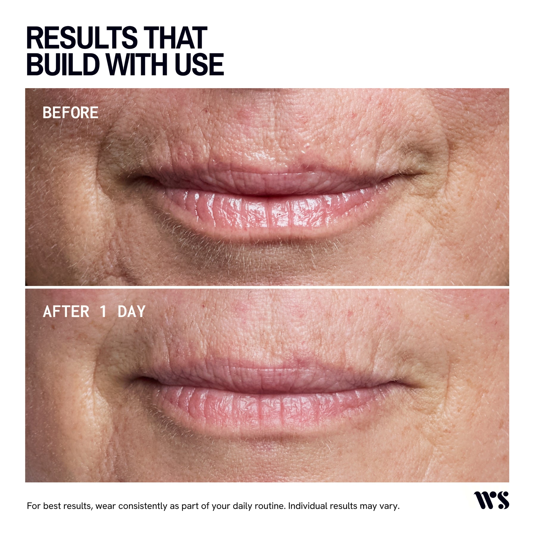 Wrinkles Schminkles Mouth and Lip Wrinkle Patches - 2 Patches