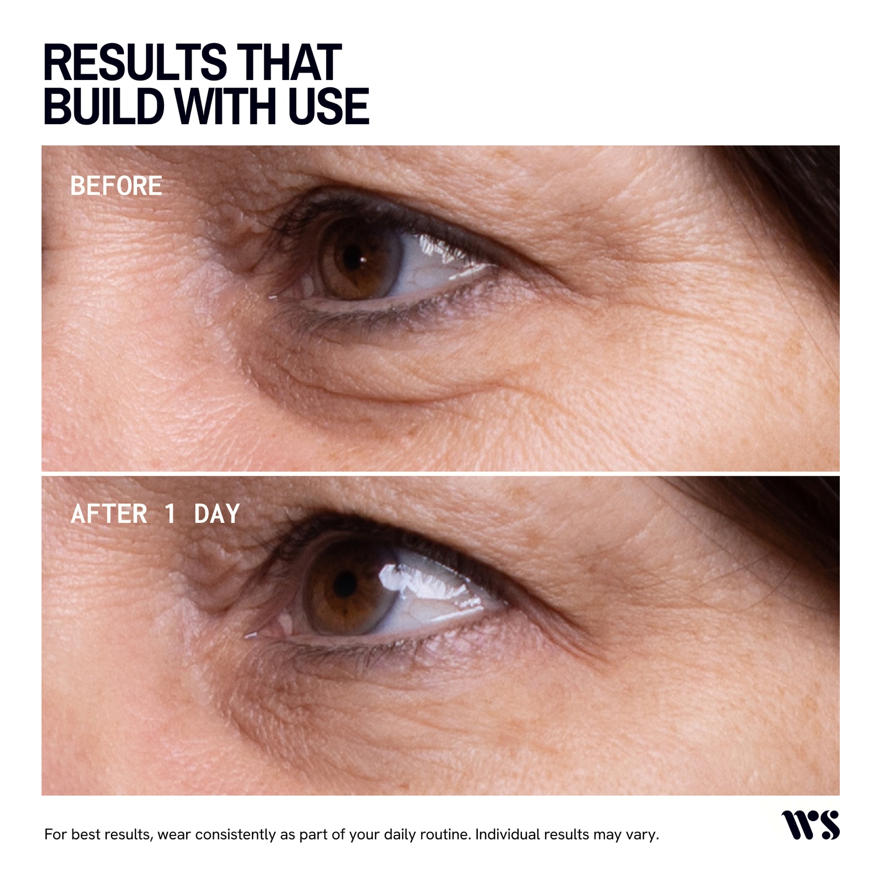 Wrinkles Schminkles Eye Wrinkle Patches - 1 Pair
