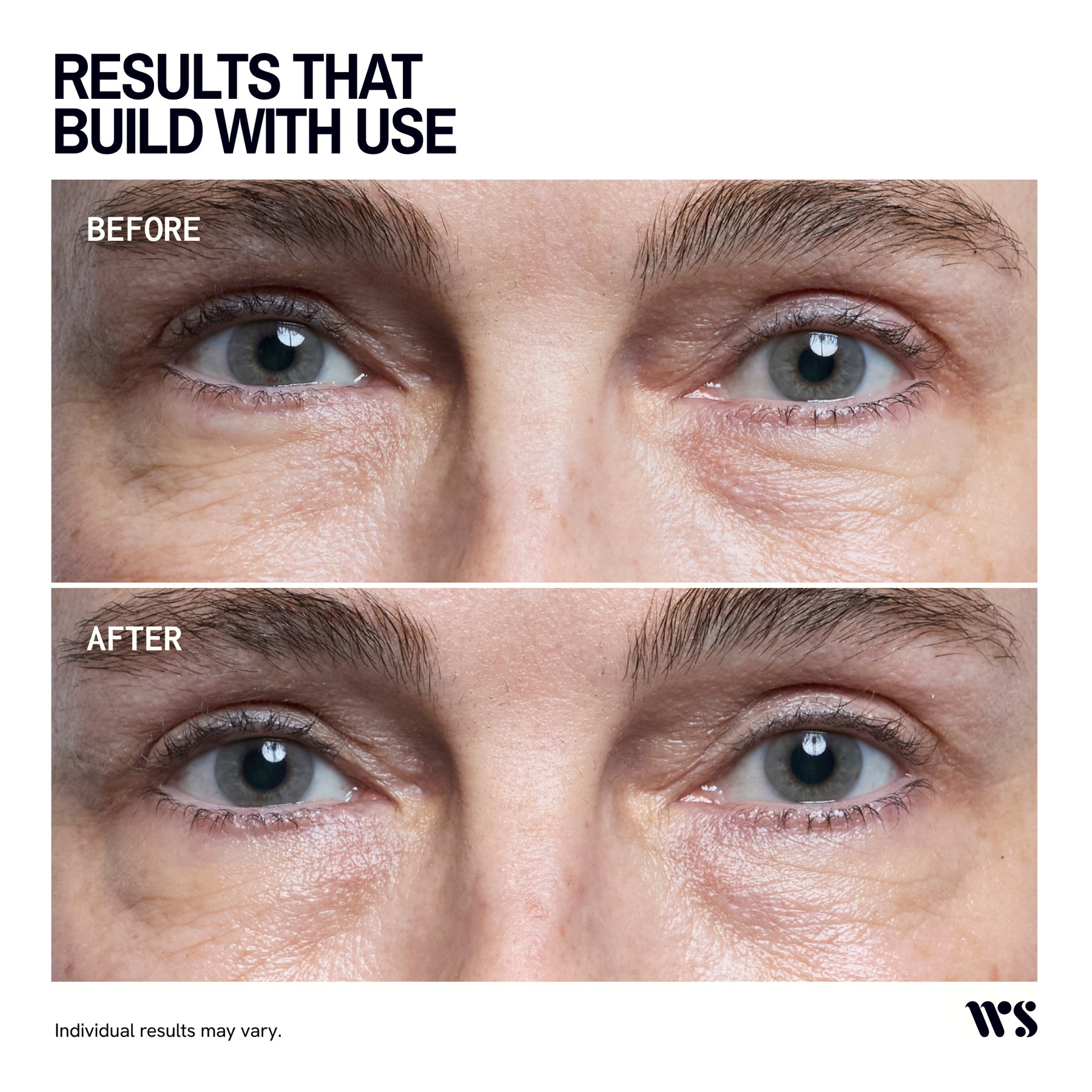 Wrinkles Schminkles Eye Brightening & Depuffing Mask - 5 Masks