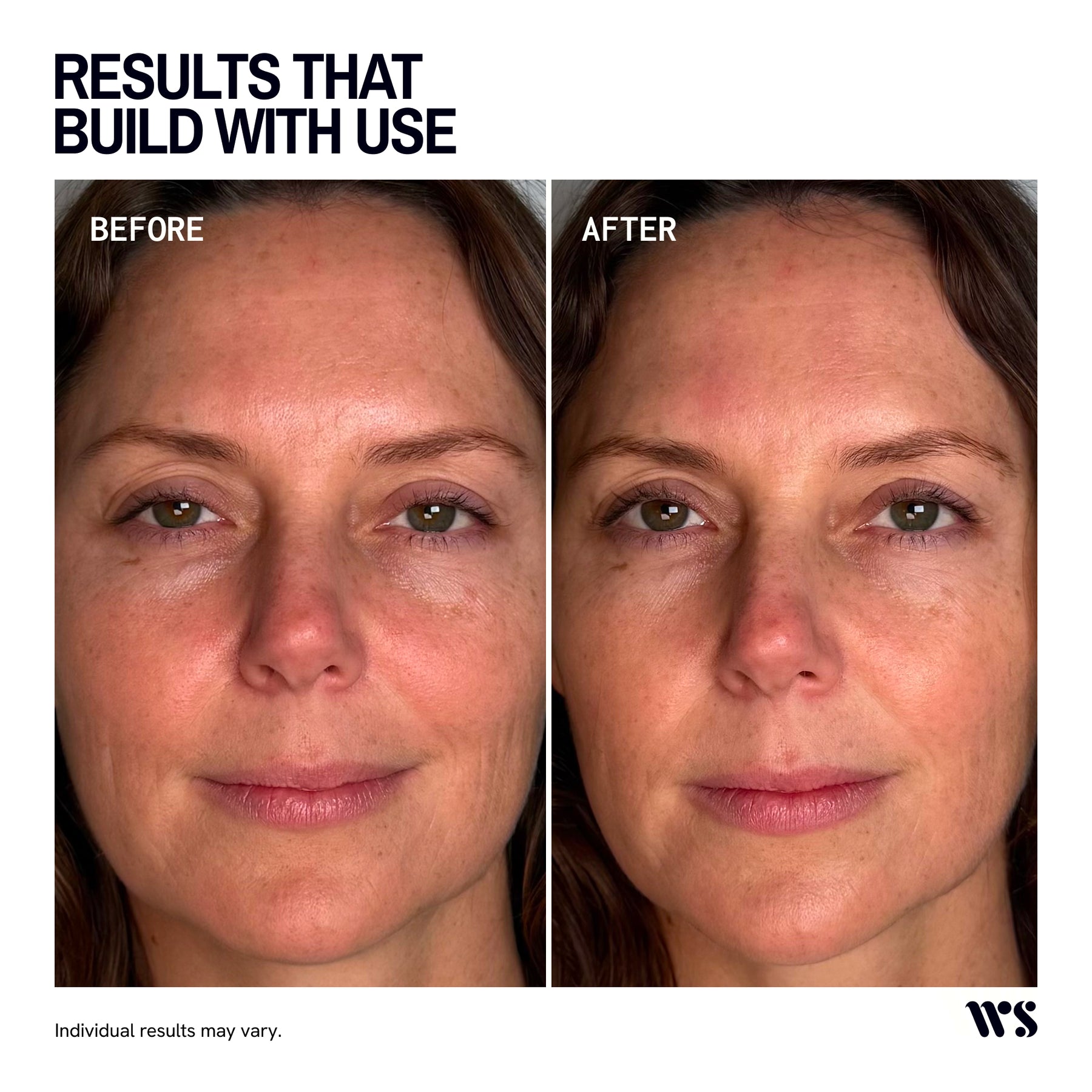 Wrinkles Schminkles Facial Plumping Facial Sheet Mask