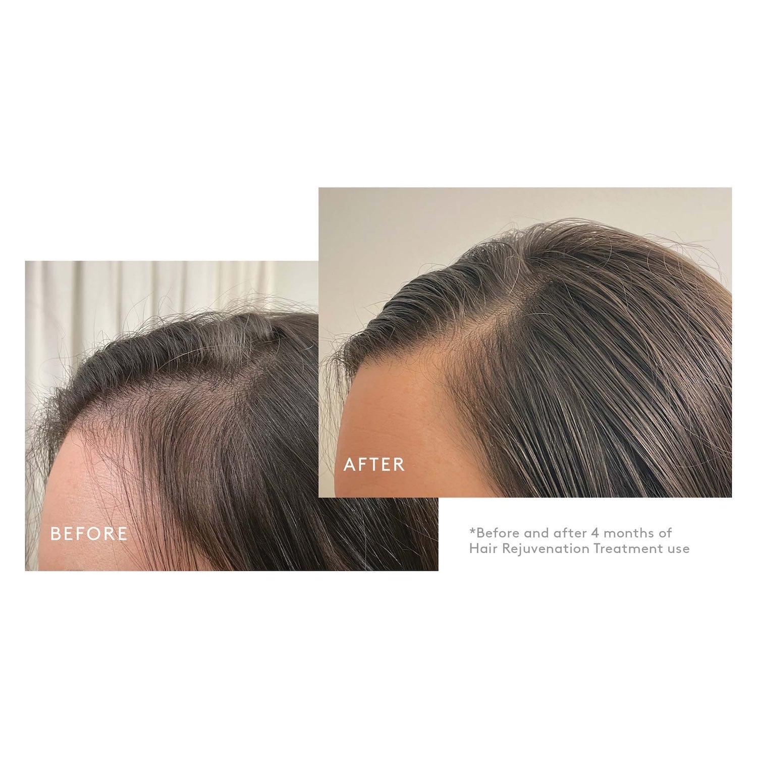 Virtue Flourish Hair Rejuvenation Treatment Kit (Phyto-Follicle Nutrient) - Full Size (90 day)