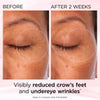 Elizabeth Arden Elizabeth Arden Retinol + HPR Ceramide Rapid Renewing Eye Cream 15ml Eye Treatments