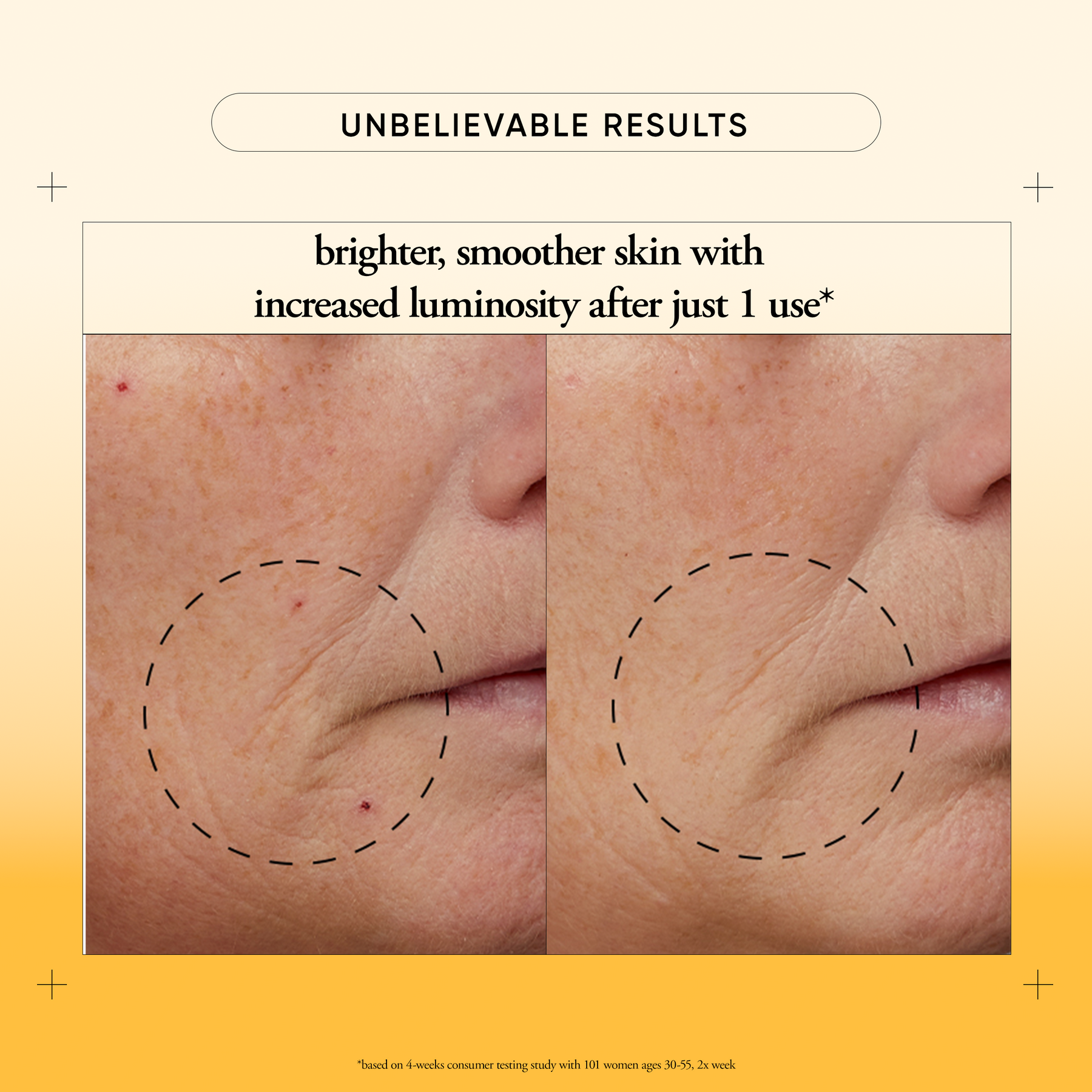 Philosophy The Microdelivery Resurfacing Mini Peel Kit