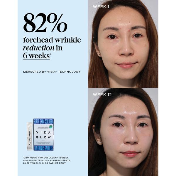 Vida Glow Pro Collagen+ Bonus Set - Limited Edition