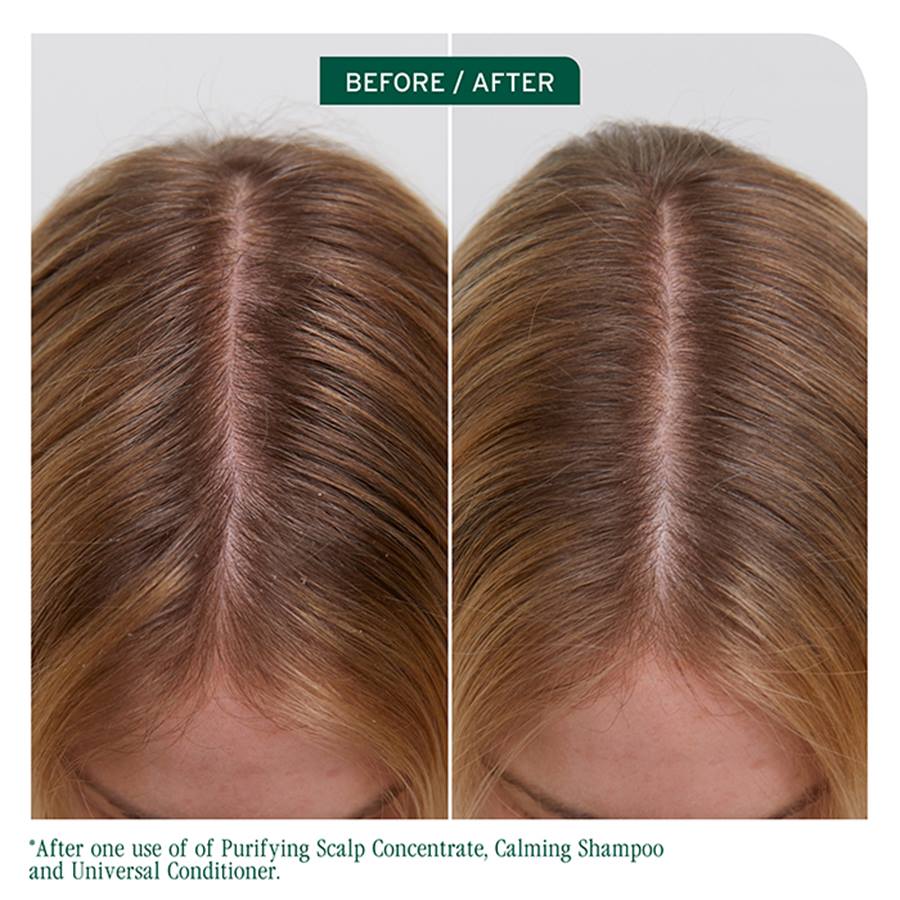 Biolage Biolage Scalp Sync Purifying Scalp Concentrate 200ml Hair Treatments