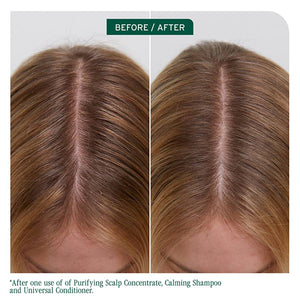 Biolage Biolage Scalp Sync Purifying Scalp Concentrate 200ml Hair Treatments