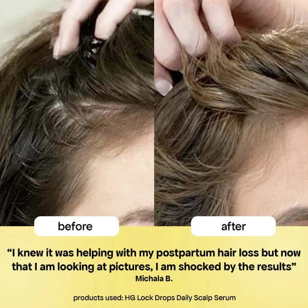 Bondi Boost Bondi Boost Lock Drops Anti-Shedding Scalp and Hair Serum 30ml Hair Oils & Serums