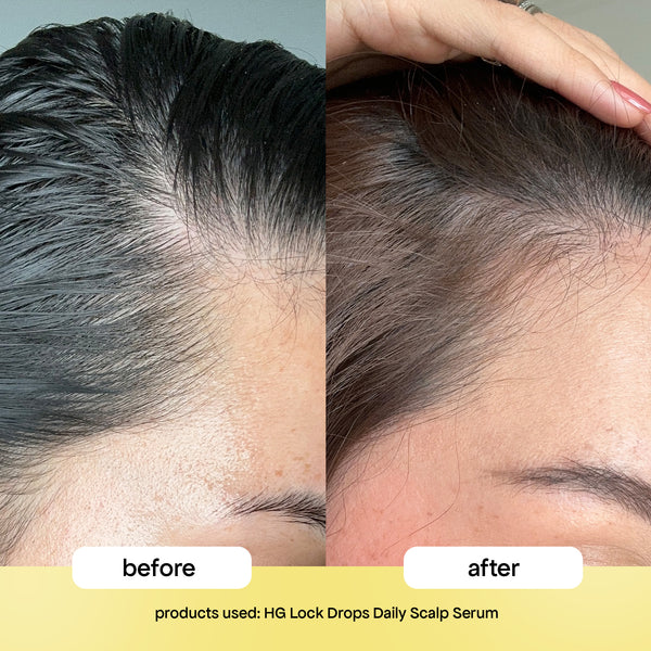 Bondi Boost Bondi Boost Lock Drops Anti-Shedding Scalp and Hair Serum 30ml Hair Oils & Serums