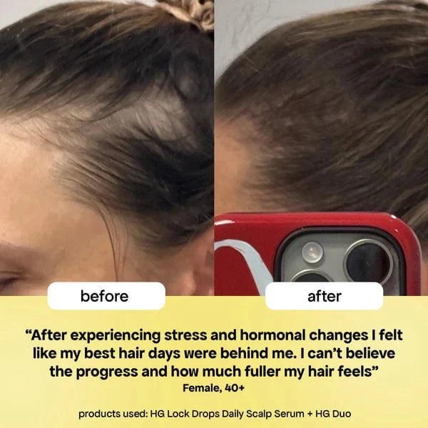 Bondi Boost Bondi Boost Lock Drops Anti-Shedding Scalp and Hair Serum 60ml Hair Oils & Serums