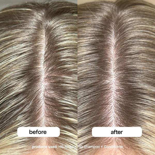 Bondi Boost Bondi Boost HG Clarifying Scalp & Hair Rinse 250ml Hair Treatments