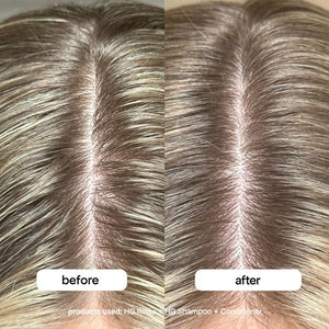 Bondi Boost Bondi Boost HG Clarifying Scalp & Hair Rinse 250ml Hair Treatments