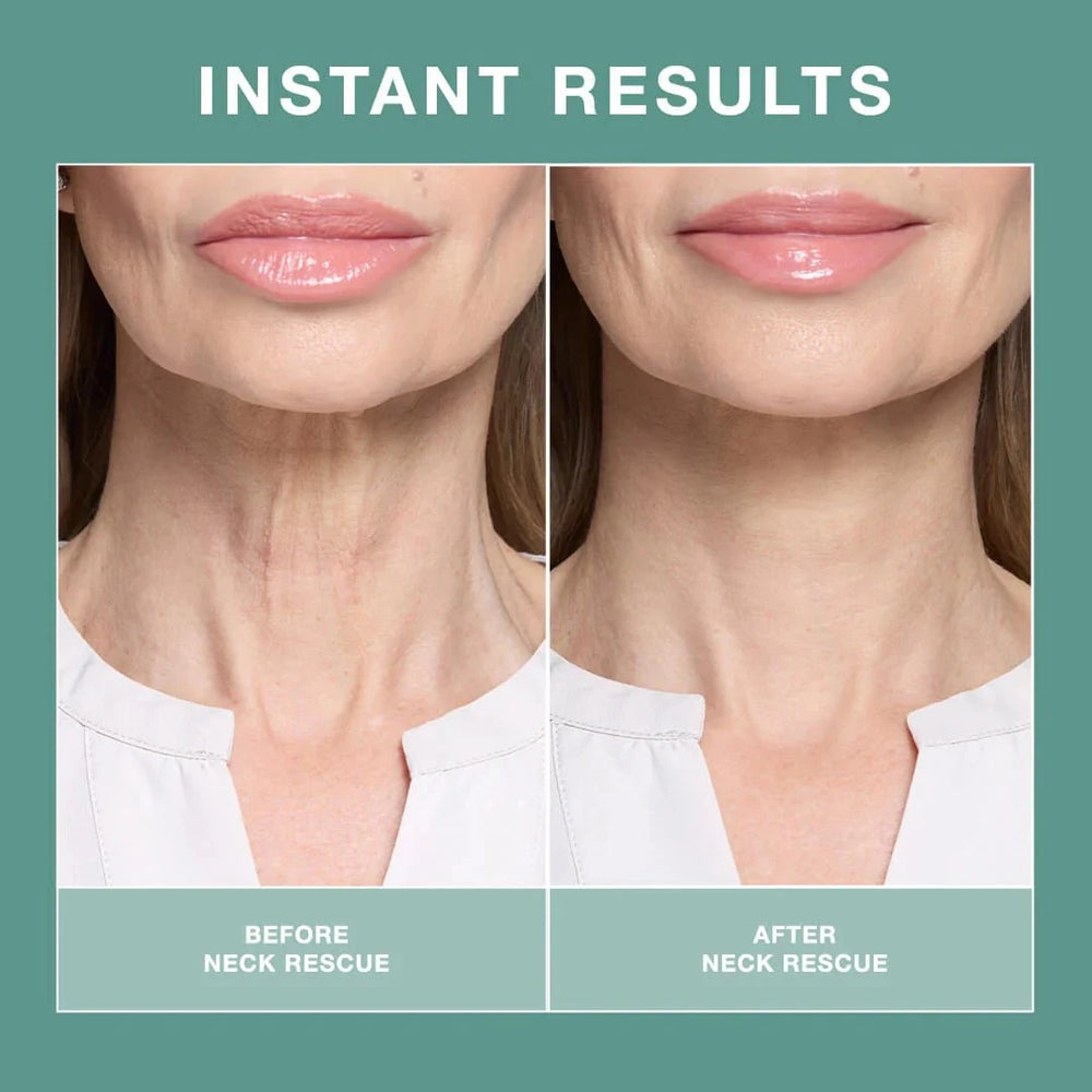 Contours RX Contours Rx NECK RESCUE 30 Strips Neck & Decolletage