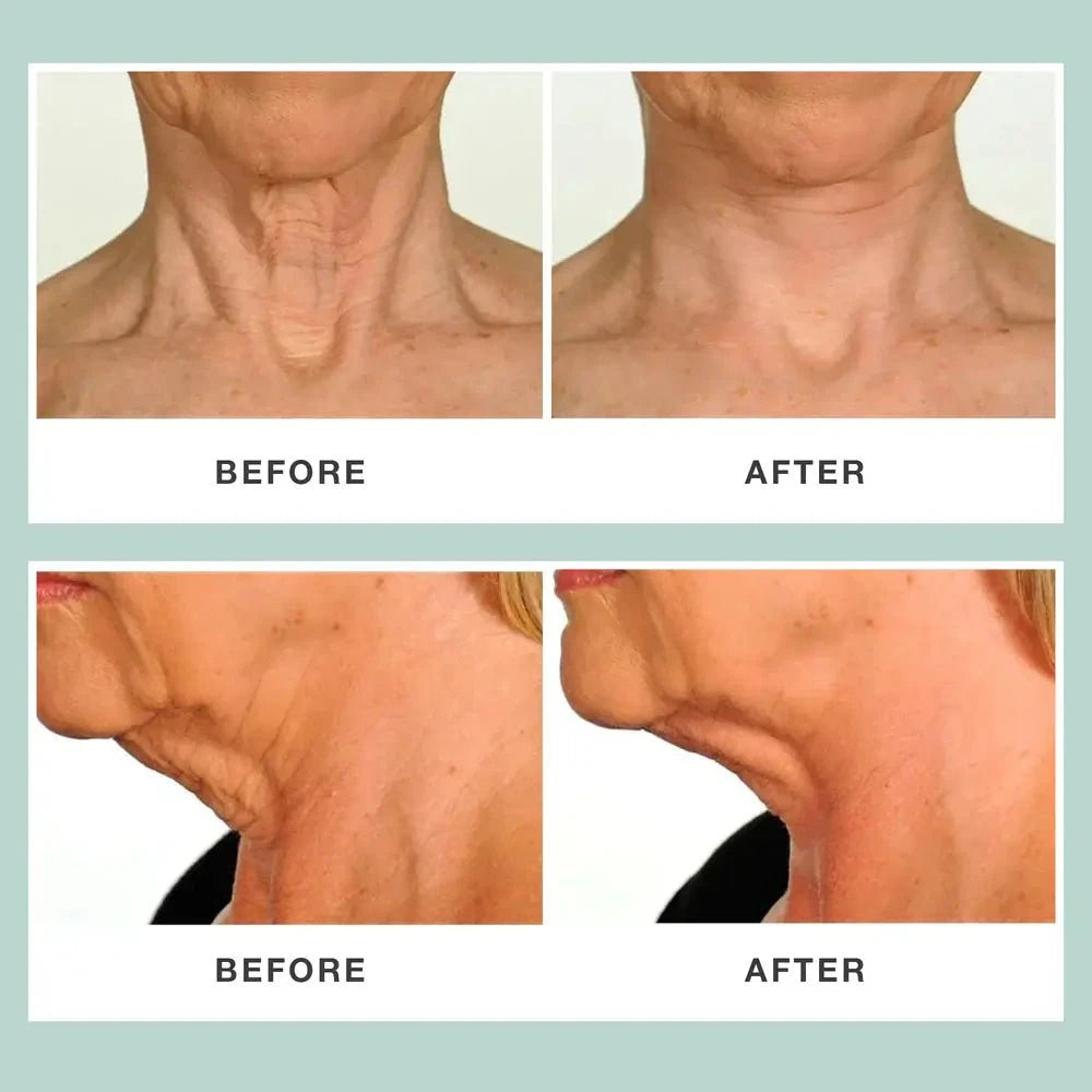 Contours RX Contours Rx NECK RESCUE 30 Strips Neck & Decolletage