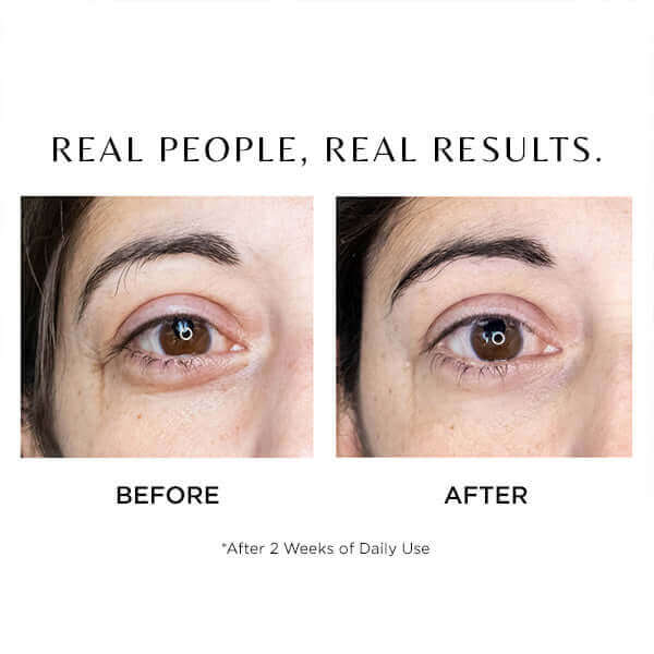 CosMedix Cosmedix Elite I-Complex 10ml Eye Treatments