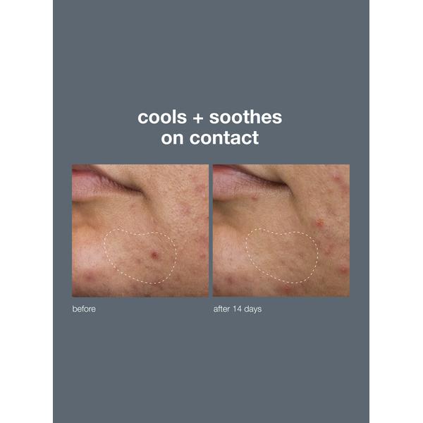Dermalogica Dermalogica Active Clearing Deep Breakout Liquid Patch 15ml Cleansers