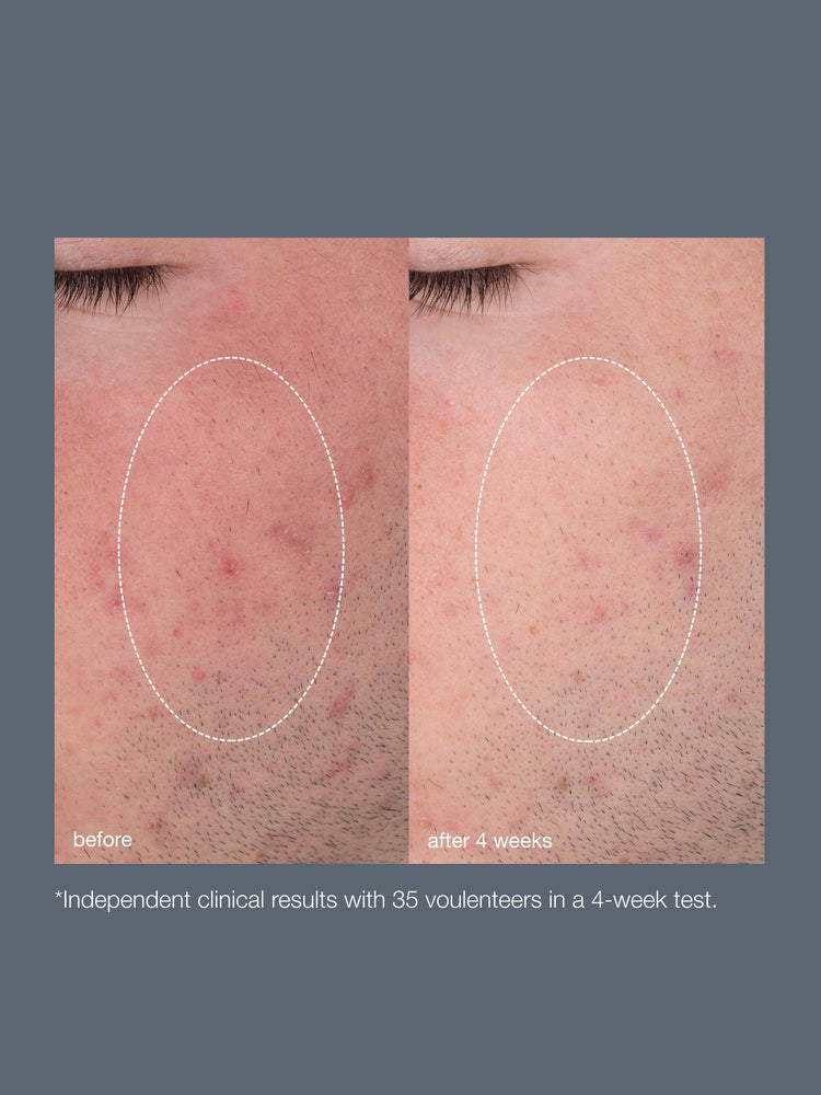 Dermalogica Dermalogica Daily Microfoliant 74g Exfoliators