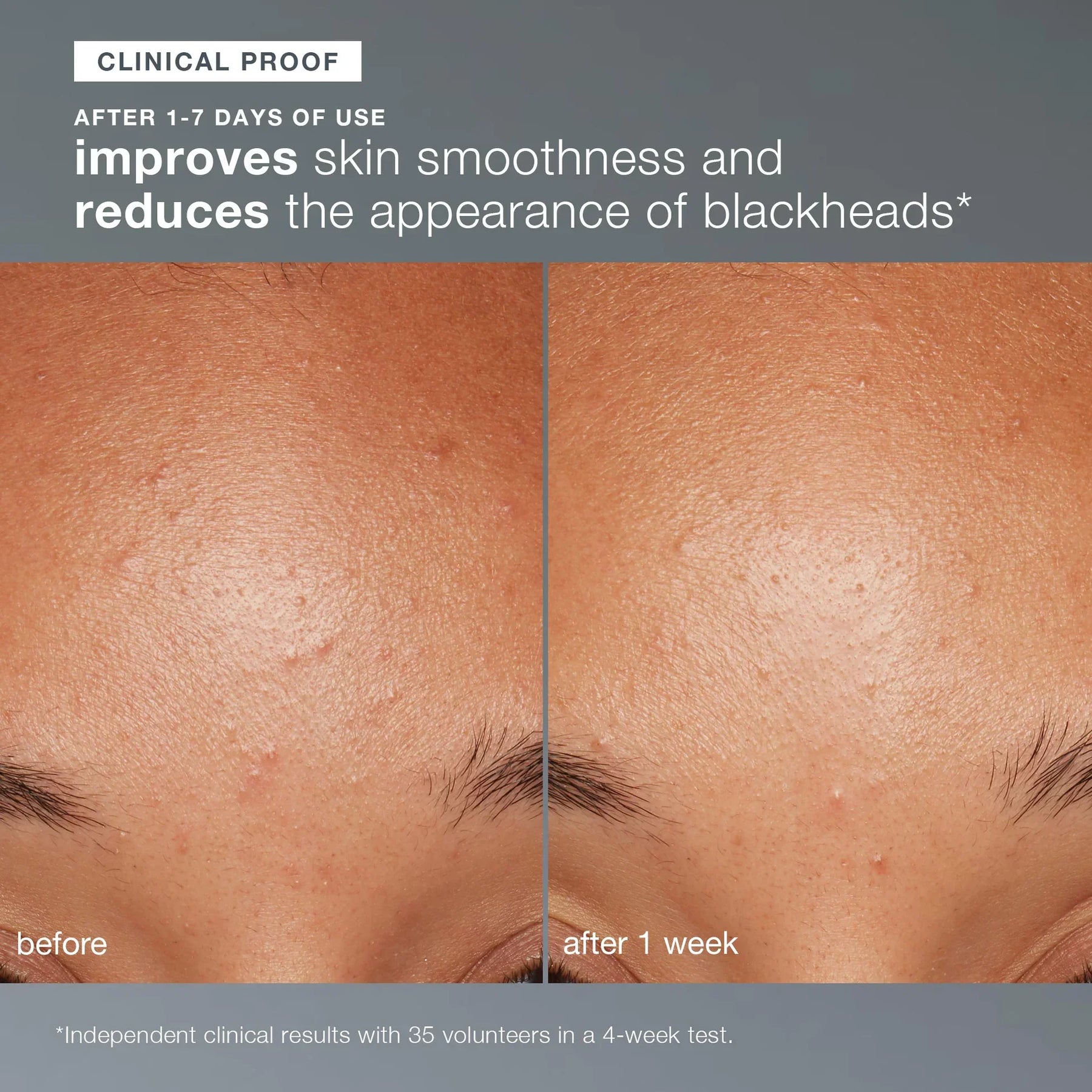 Dermalogica Dermalogica Daily Microfoliant 74g Exfoliators