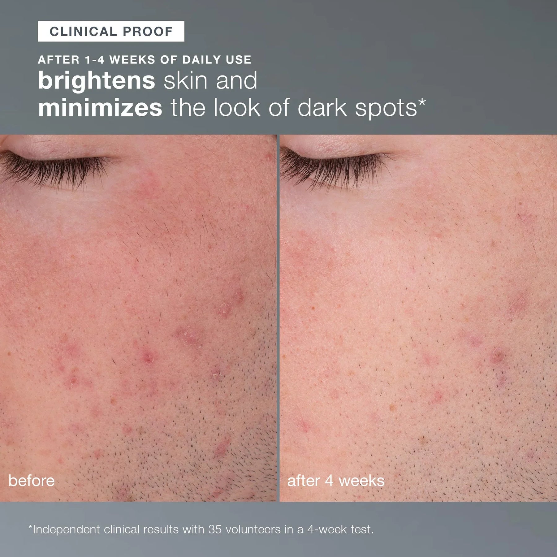 Dermalogica Dermalogica Daily Microfoliant 74g Exfoliators