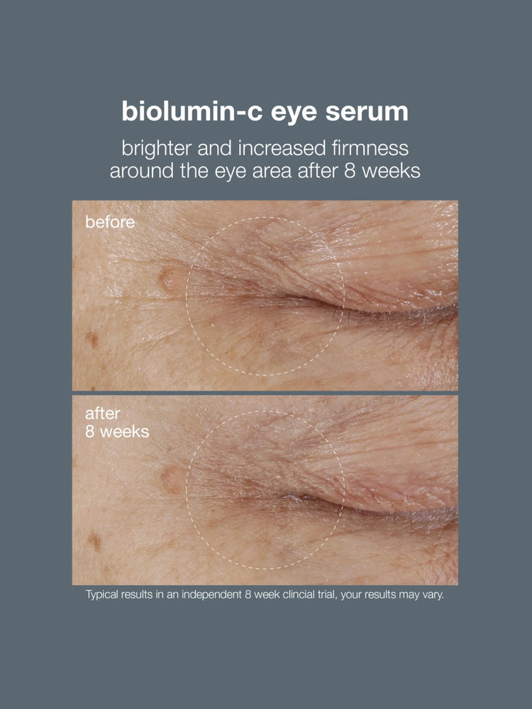 Dermalogica Dermalogica BioLumin-C Eye Serum 15ml Eye Treatments