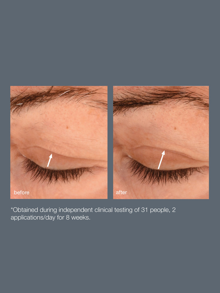 Dermalogica Dermalogica Phyto Nature Lifting Eye Cream 15ml Eye Treatments