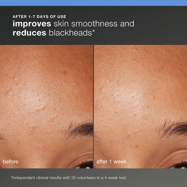 Dermalogica Dermalogica Discover Healthy Skin Kit Kits & Packs