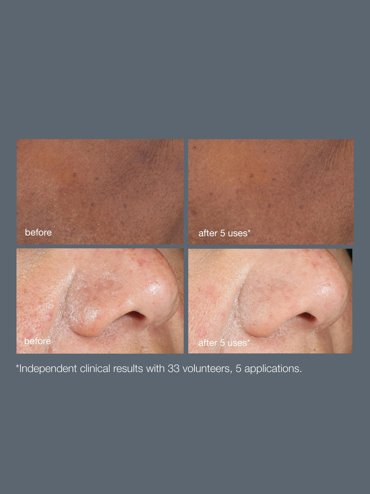 Dermalogica Dermalogica PowerBright Dark Spot Peel 50ml Peeling