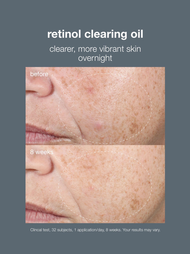 Dermalogica Dermalogica Active Clearing Retinol Clearing Oil 30ml Serums & Treatments
