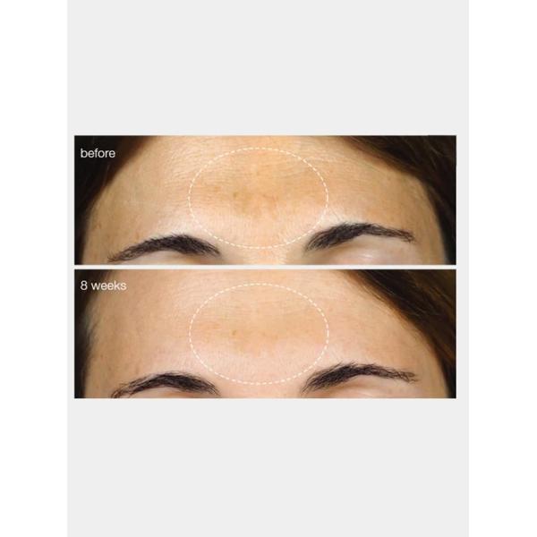 Dermalogica Dermalogica PowerBright Dark Spot Serum 30ml Serums & Treatments
