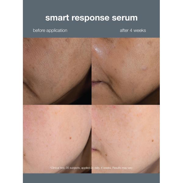Dermalogica Dermalogica Smart Response Serum Jumbo 59ml Serums & Treatments