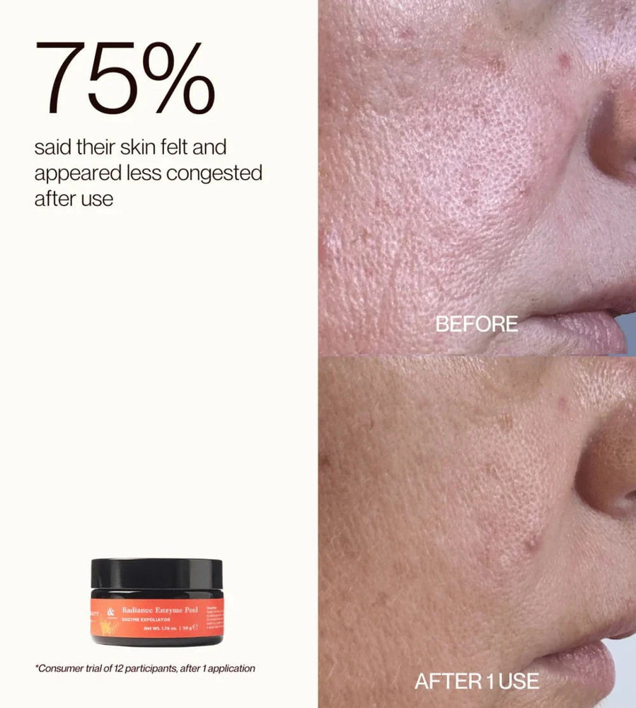 Edible Beauty Australia Edible Beauty Radiance Enzyme Peel 50g