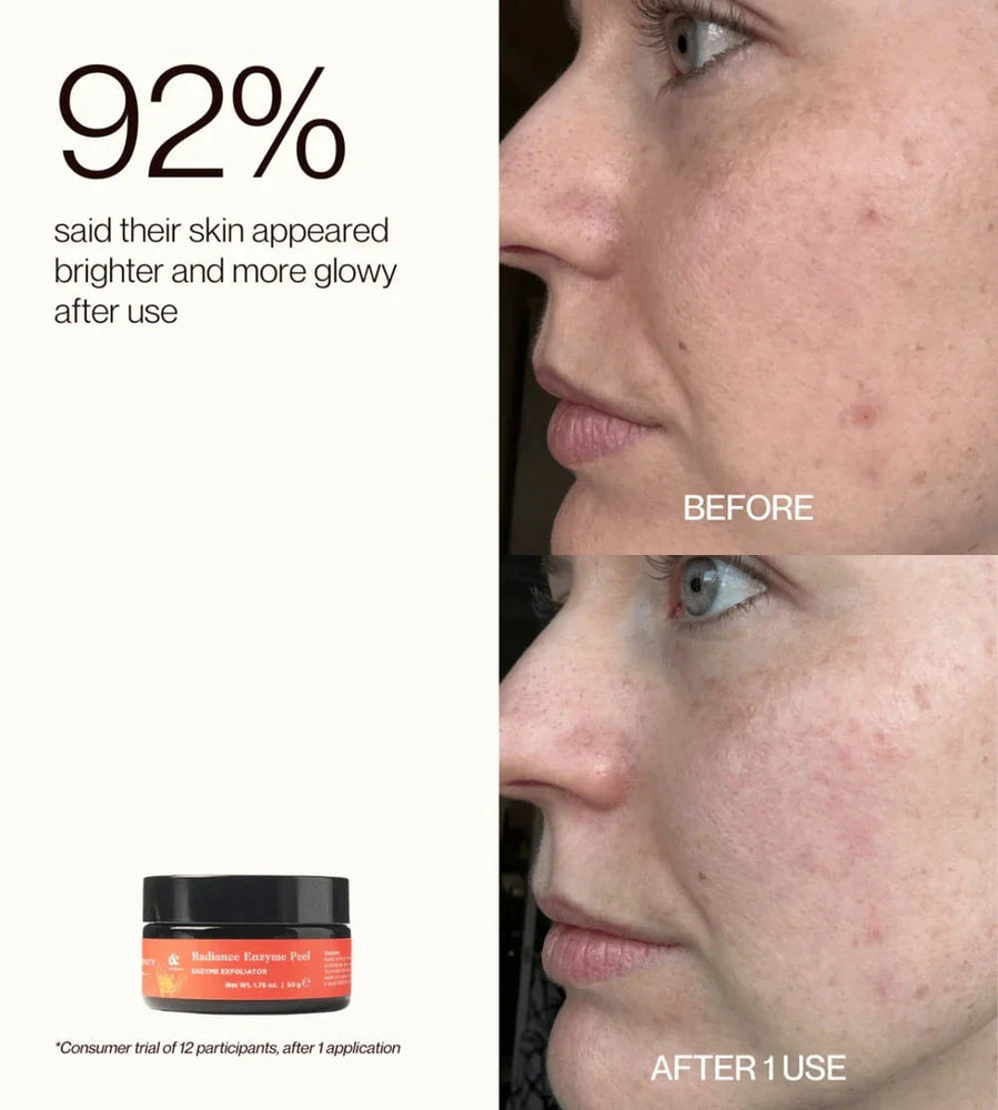 Edible Beauty Australia Edible Beauty Radiance Enzyme Peel 50g