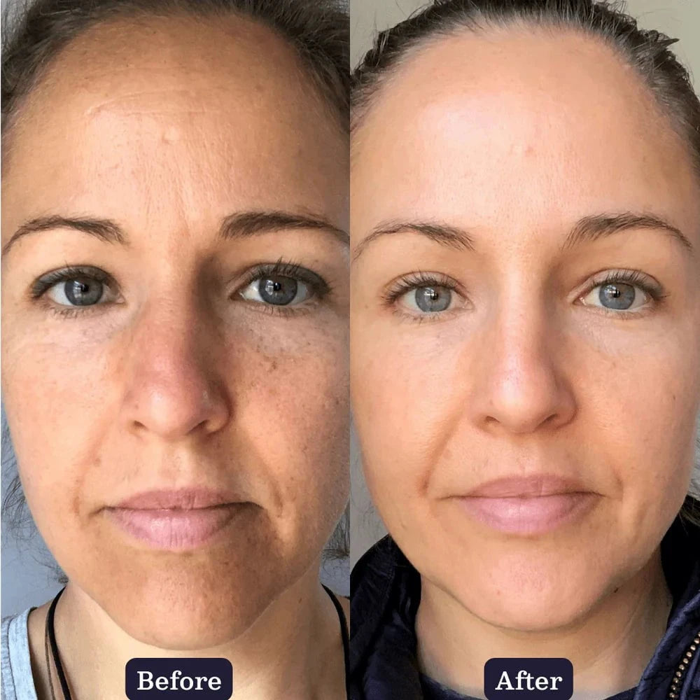 Edible Beauty Australia Edible Beauty Collagen Boosting Duo Skin Care