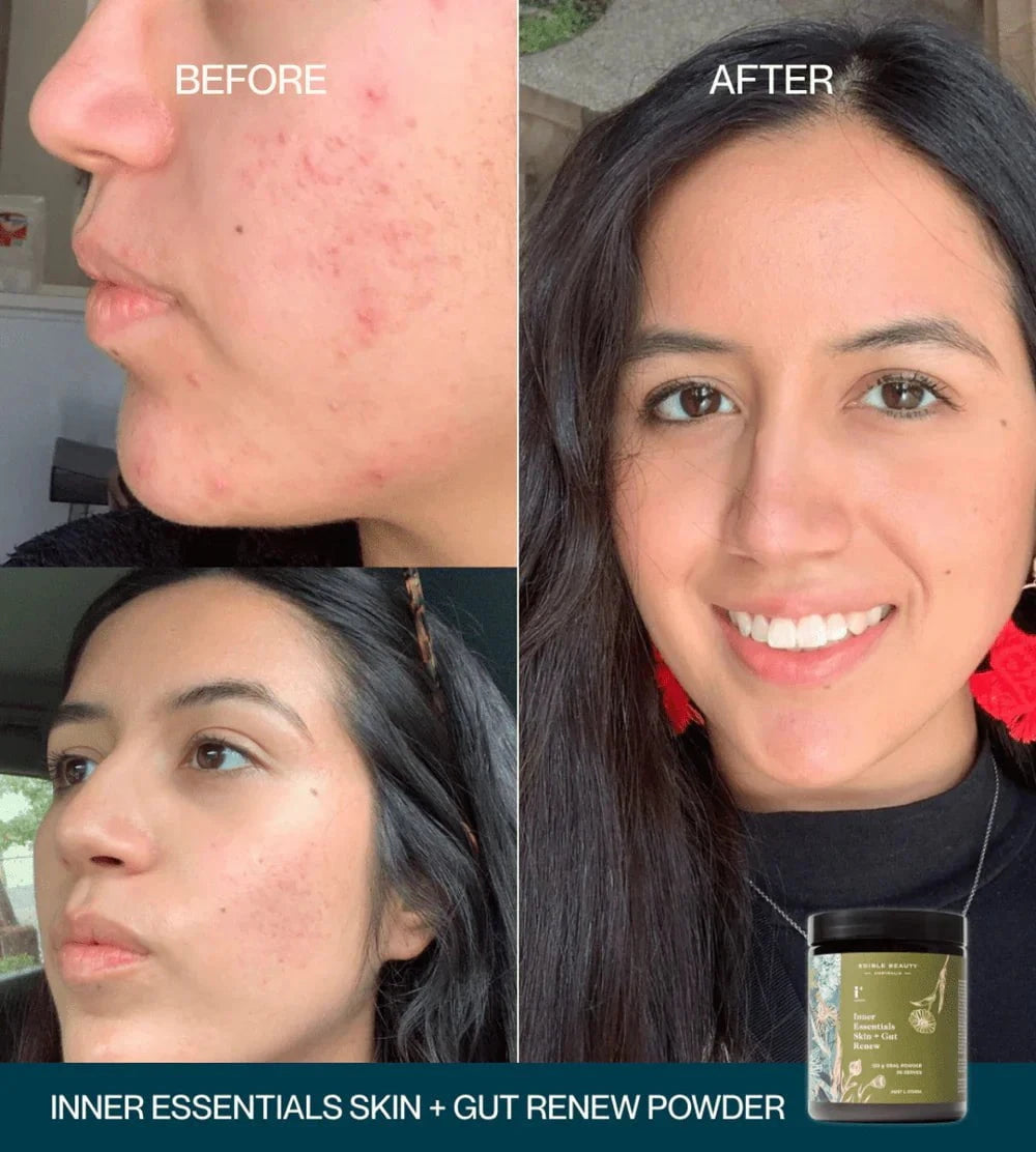 Edible Beauty Australia Edible Beauty Inner Essentials - Skin + Gut Renew Powder 120g Skin Care