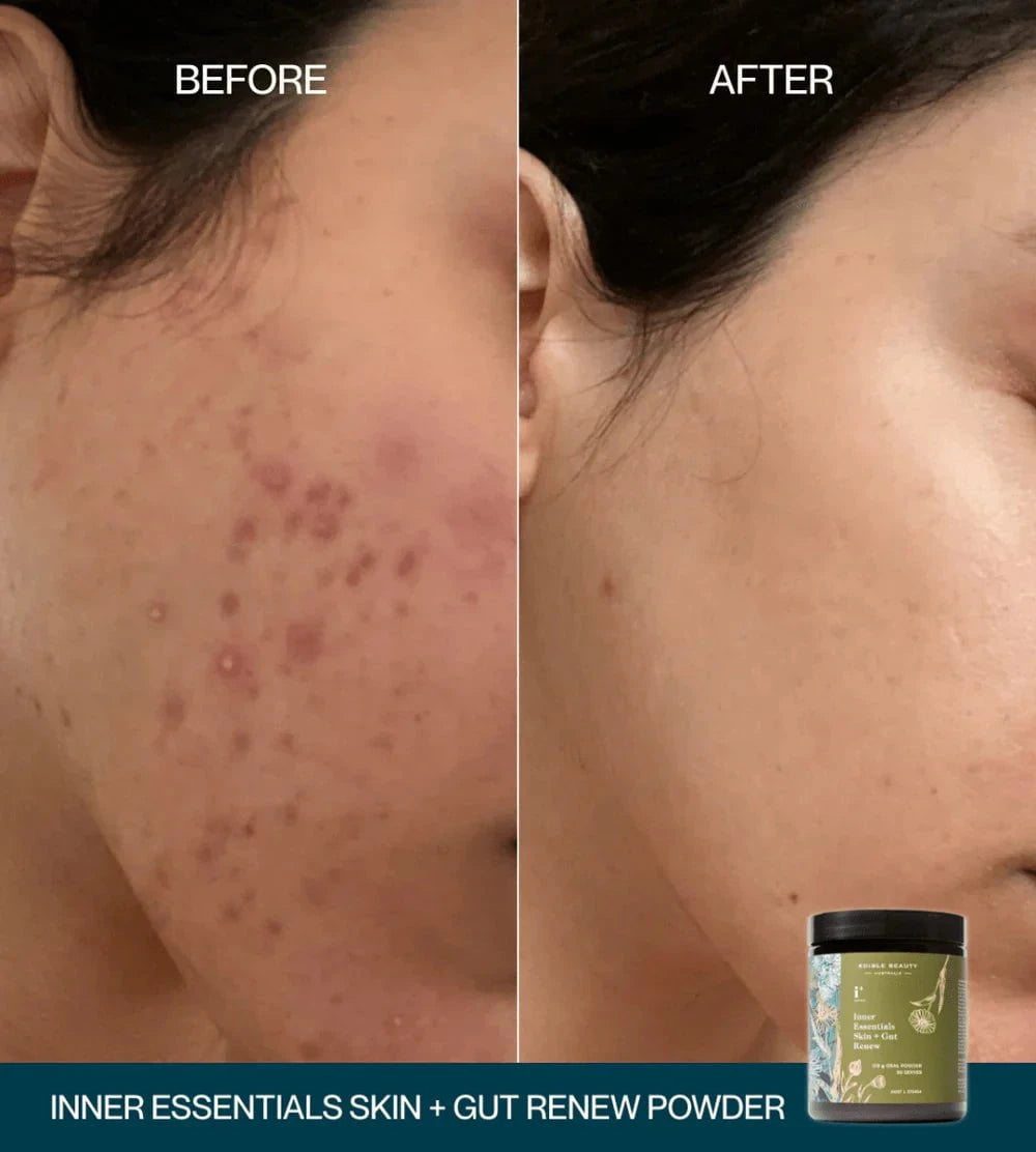 Edible Beauty Australia Edible Beauty Inner Essentials - Skin + Gut Renew Powder 120g Skin Care