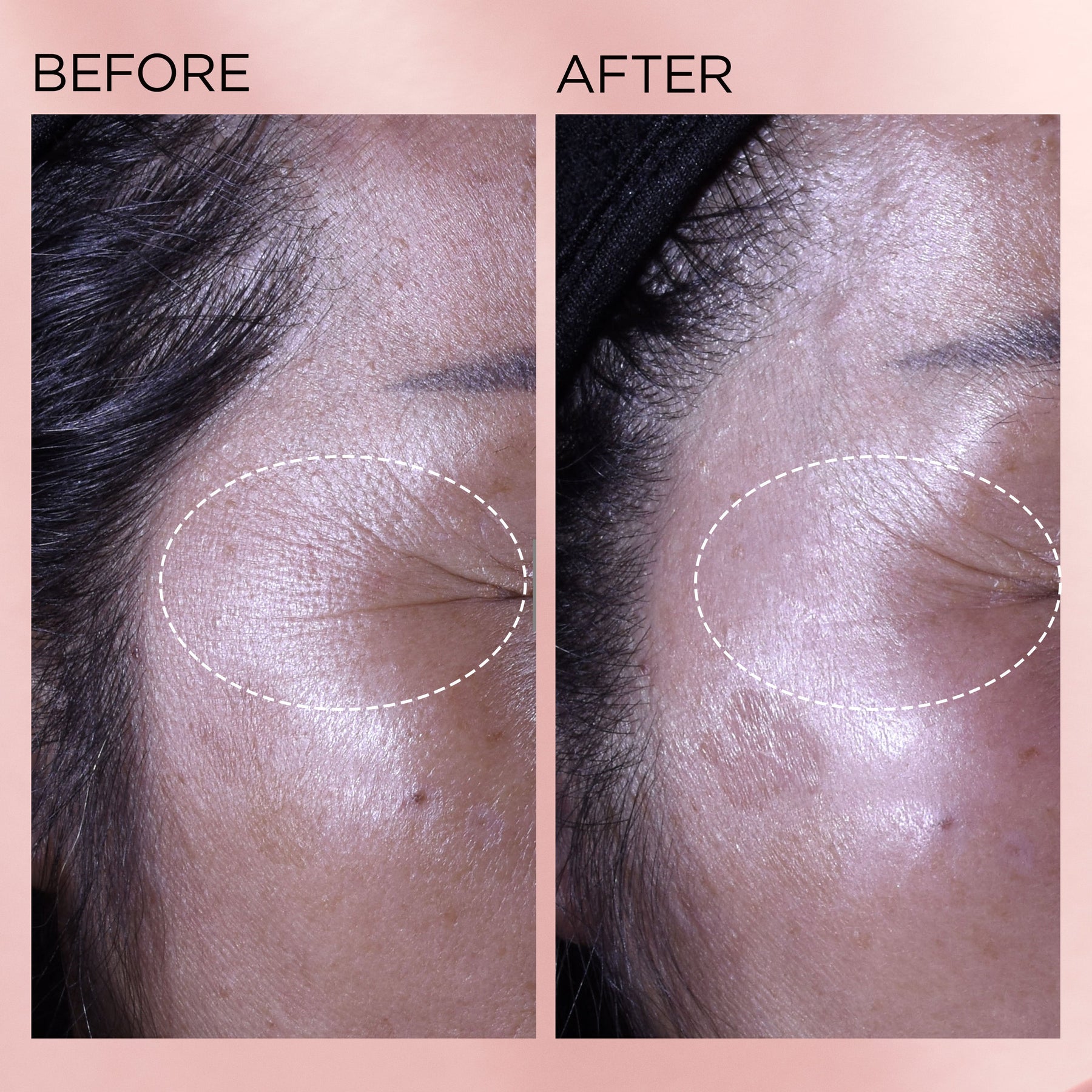 Elizabeth Arden Elizabeth Arden Retinol + HPR Ceramide Capsules Rapid Skin Renewing Serum 60 Piece Serums & Treatments