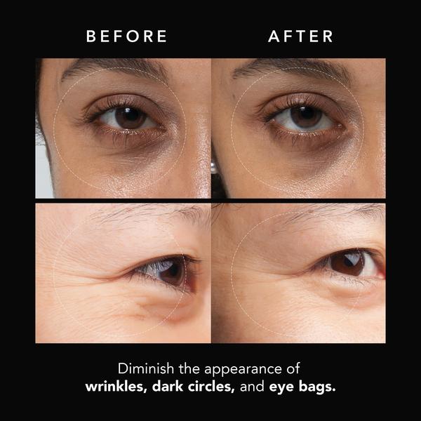 FOREO FOREO FAQ Under Eye Microneedling Anti-Wrinkle Hyaluronic Acid Patches 3 Pairs Facial Masks