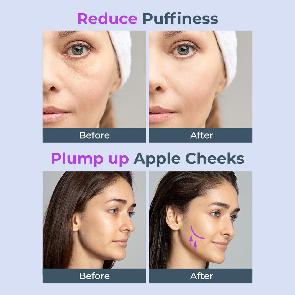 FOREO FOREO BEAR 2 go Skin Care