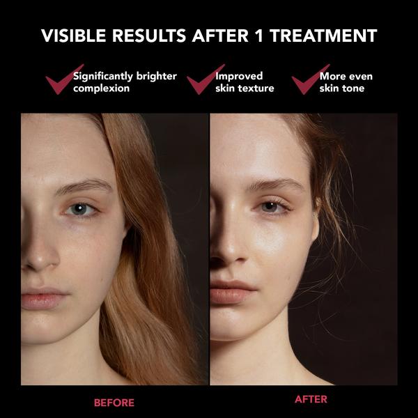 FOREO FOREO FAQ 201 LED Face Mask Skin Care [Health and Beauty]
