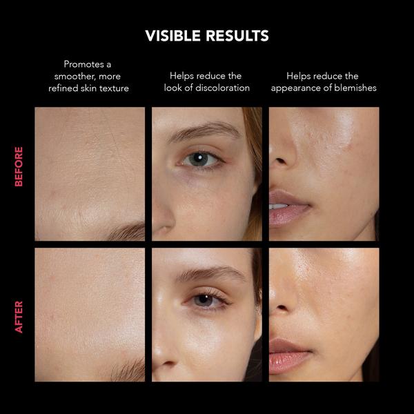 FOREO FOREO FAQ 202 LED Face Mask Skin Care [Health and Beauty]