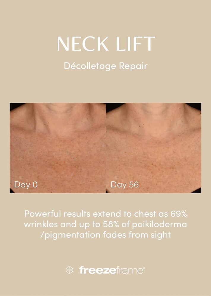 freezeframe freezeframe Neck Lift 50ml Neck & Decolletage