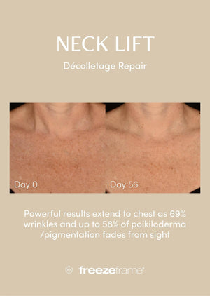 freezeframe freezeframe Neck Lift 50ml Neck & Decolletage