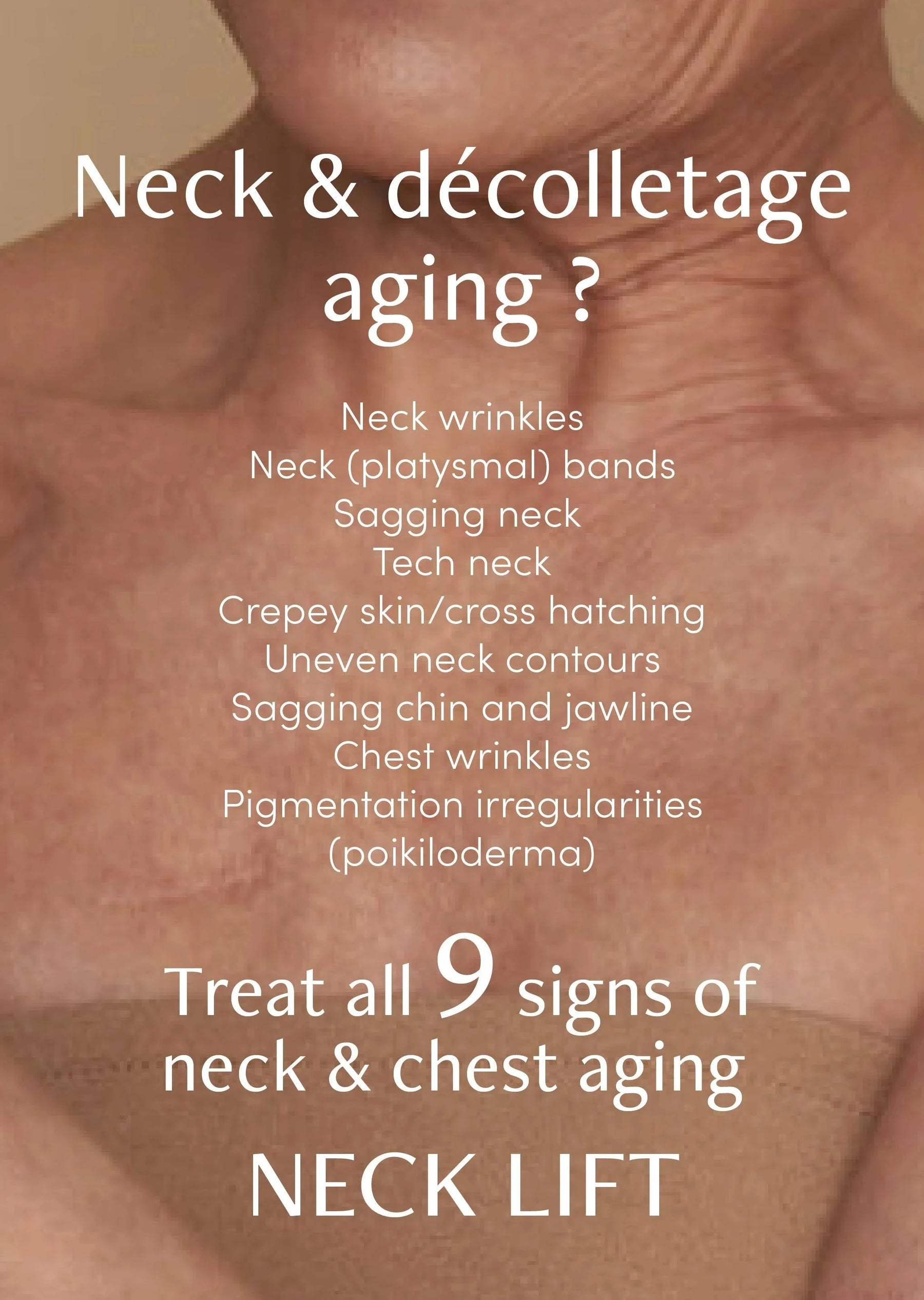 freezeframe freezeframe Neck Lift 50ml Neck & Decolletage