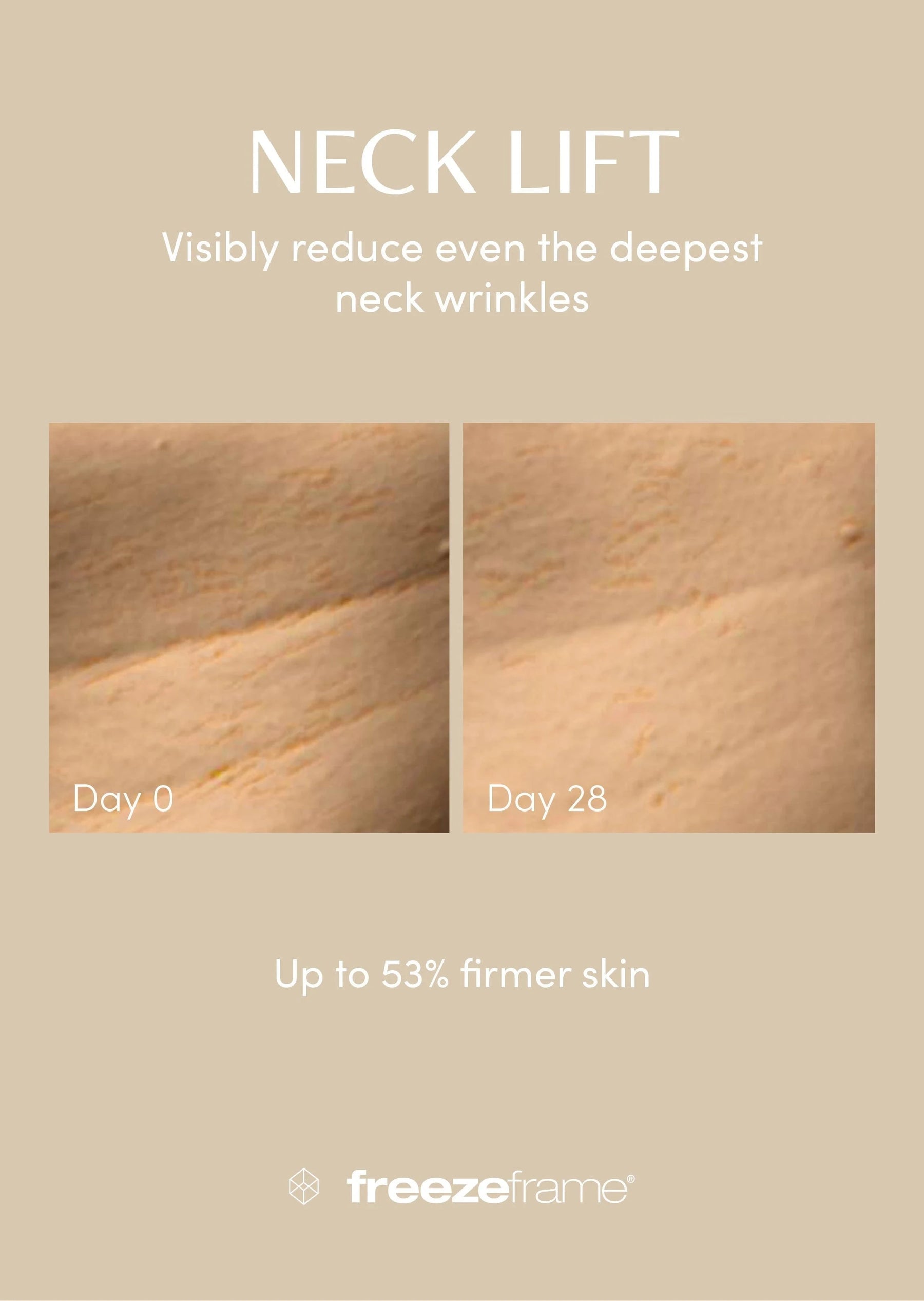 freezeframe freezeframe Neck Lift 50ml Neck & Decolletage