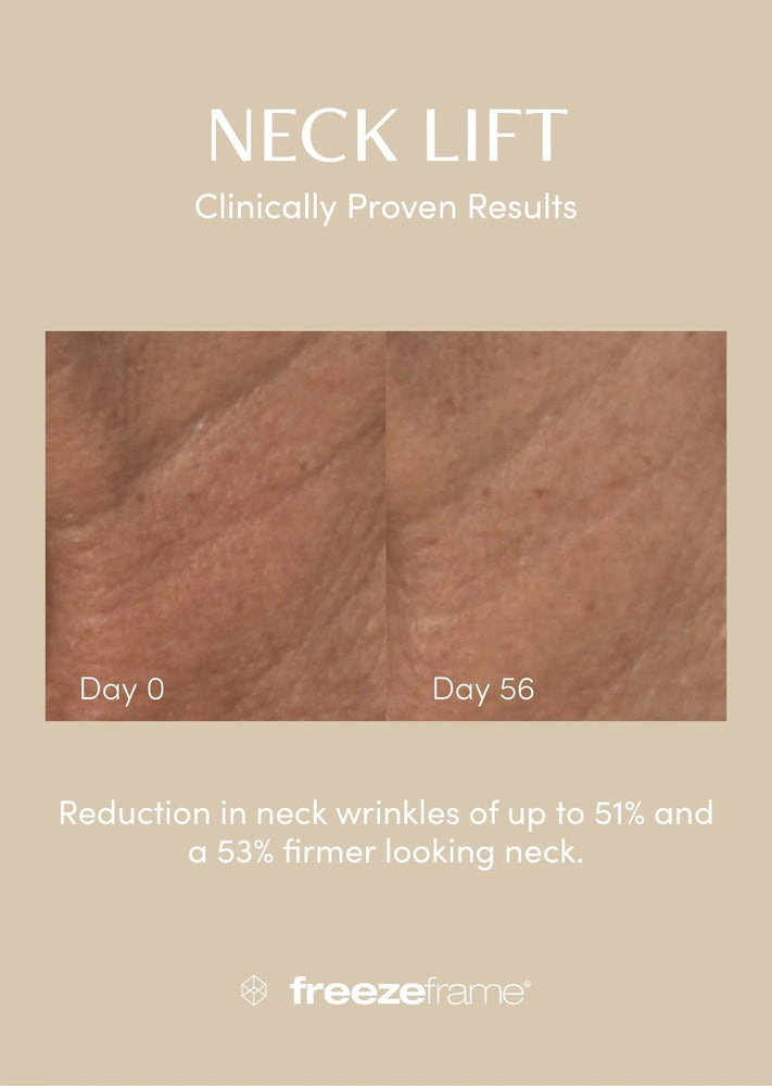 freezeframe freezeframe Neck Lift 50ml Neck & Decolletage